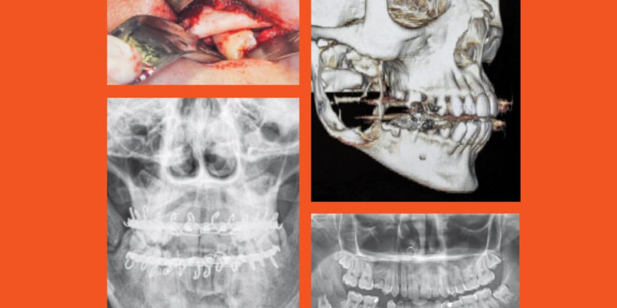 destaque-jbcoms-v06n2