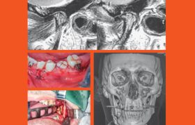 destaque-jbcoms-v06n3