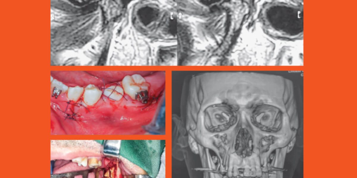 destaque-jbcoms-v06n3