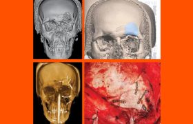 destaque-jbcoms-v07n1