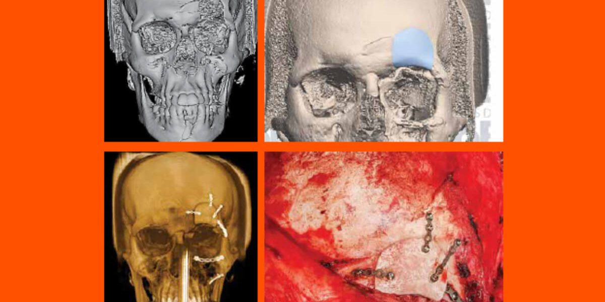 destaque-jbcoms-v07n1