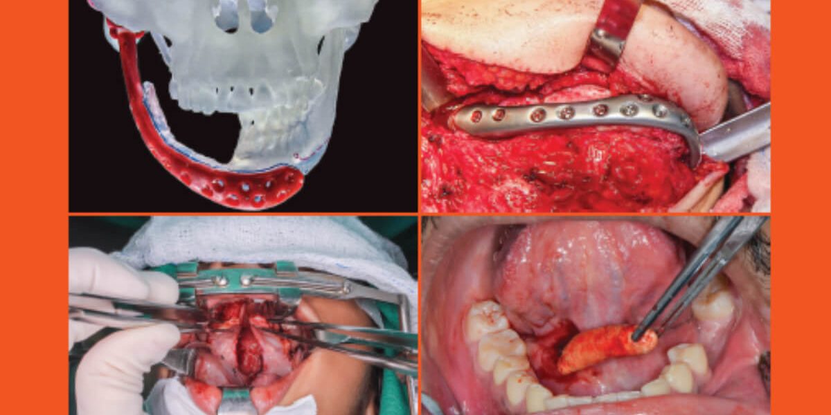 destaque-jbcoms-v07n2